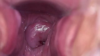 Chupa mete e não tira combinado?