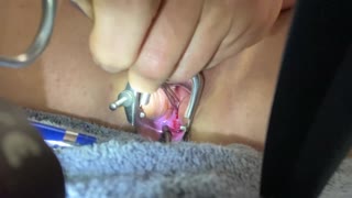 Masochist slave spreads shaved pussy for extreme medical sounding and speculum insertion