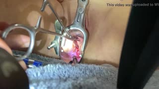 Masochist slave spreads shaved pussy for extreme medical sounding and speculum insertion