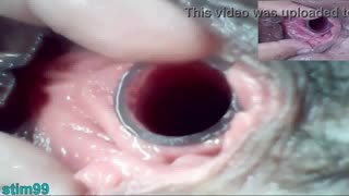 Lesbians Hammer Extreme Cervix Play and Peehole Dildo Penetration