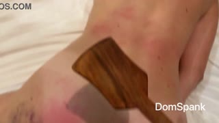 أنا حساسة جدا بعد هذا العضو الشرجي العنيف